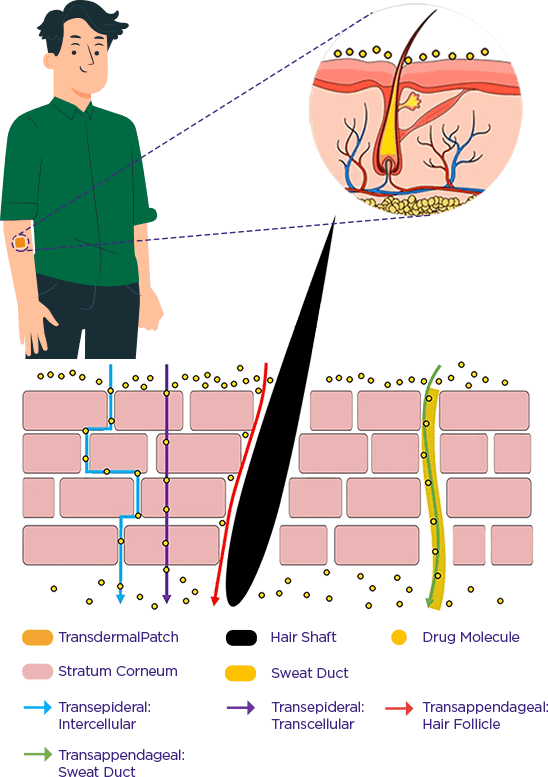 Schematic representation of transdermal drug